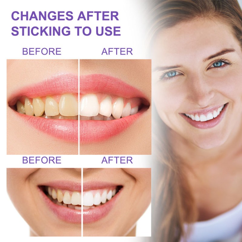 Teeth Whitening Toothpaste Manufacturer - OEM Remove Yellow Stains Odor Oral Fresh Breath