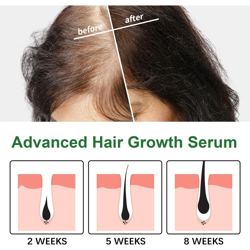 Hair Growth Serum Manufacturer - Custom Private Label EELHOE Advanced Stimulate Roots
