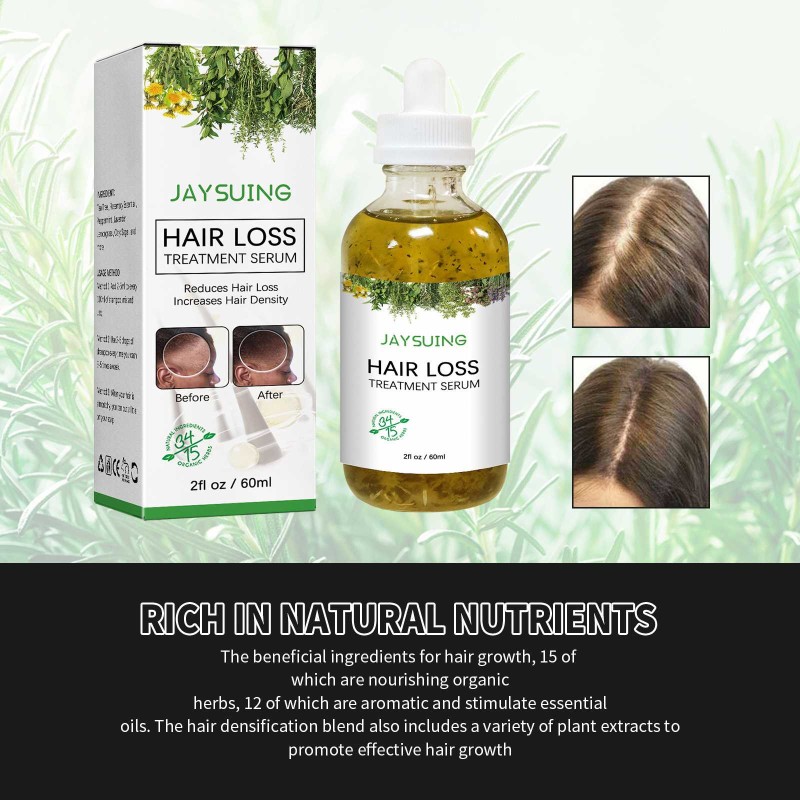 Hair Growth Oil Serum Manufacturer - OEM Hot Selling Private Label 100% Natural Nourishing
