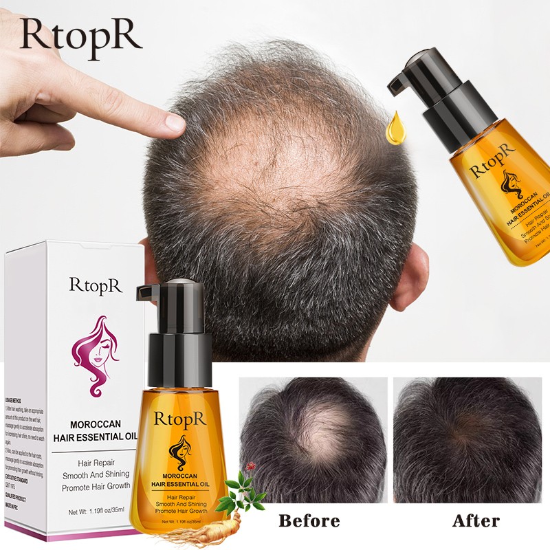 Hair Growth Oil Manufacturer - Private Label Moroccan Dry Damaged Hair Repairing Serum