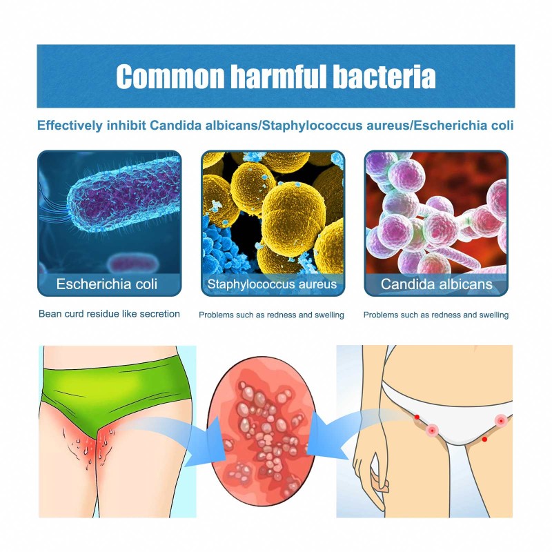 Mouth Spray Manufacturer - Private Label Oral Natural Refreshing Alcohol Free Long Lasting