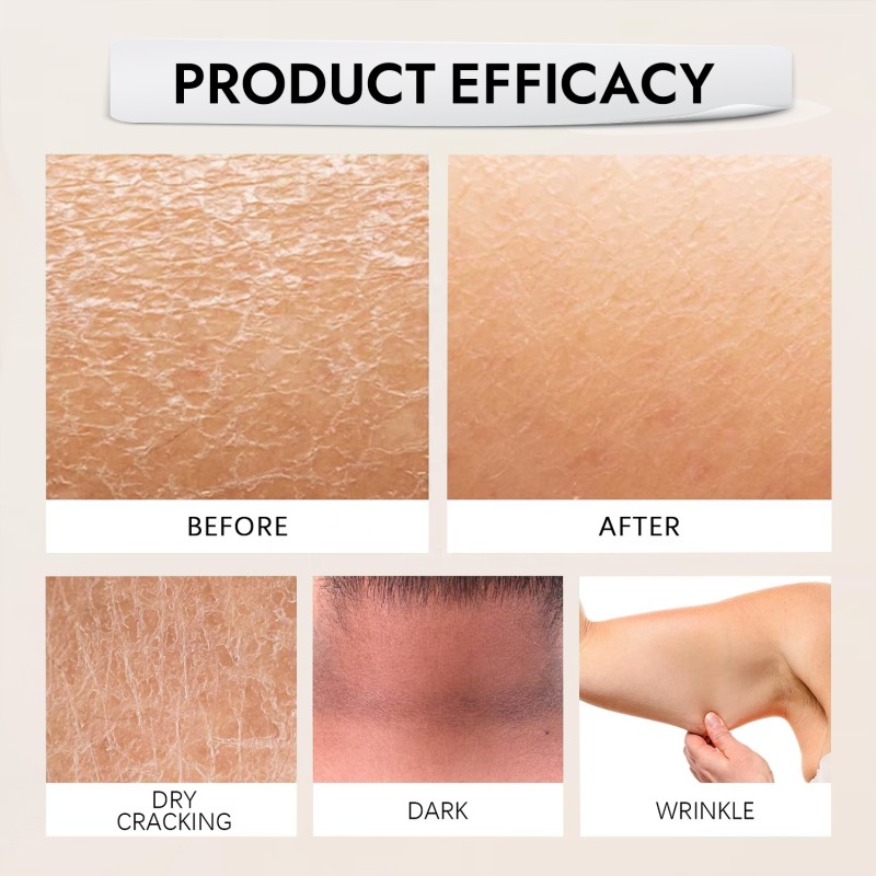 Retinol Body Lotion Manufacturer - OEM Custom Private Label Moisturizer Firming Brightening Dark Spots