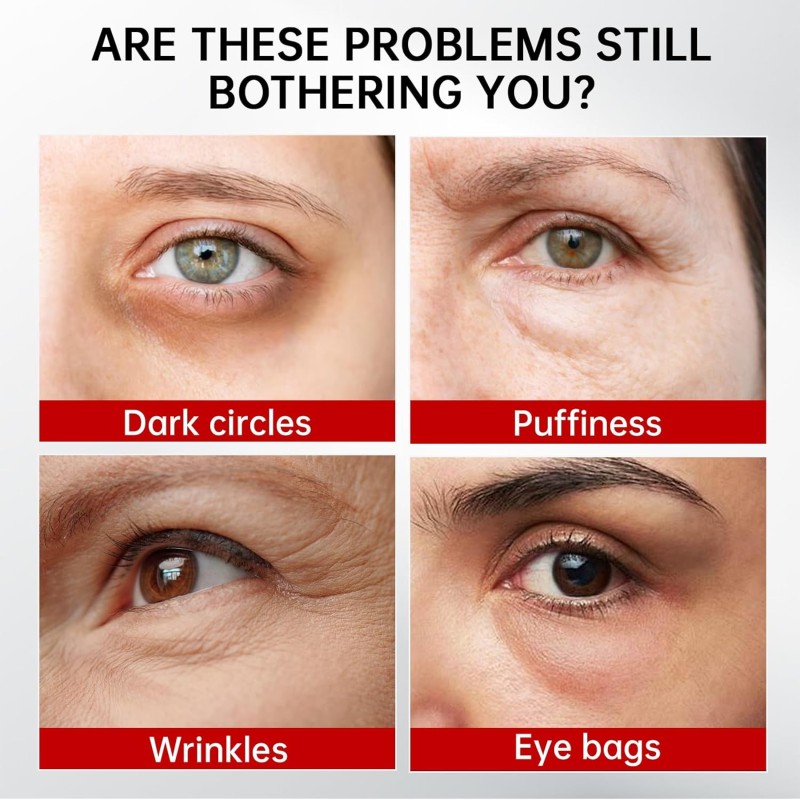 Eye Cream Manufacturer - OEM/ODM Custom LOGO Instantly Brightens Reduces Fine Lines Puffiness