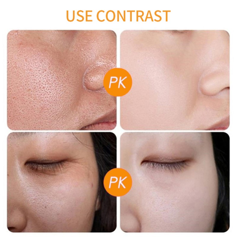 Turmeric Facial Cream Manufacturer - OEM Free Sample Private Label Niacinamide Salicylic Acid