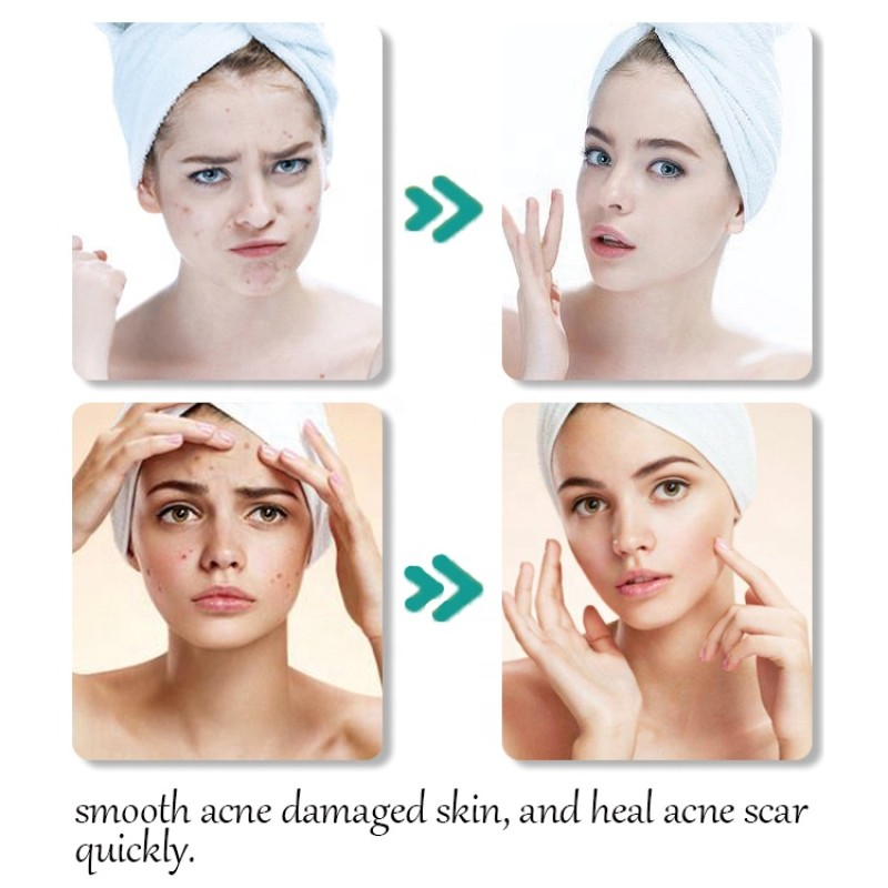 Turmeric Facial Cream Manufacturer - OEM Free Sample Private Label Niacinamide Salicylic Acid