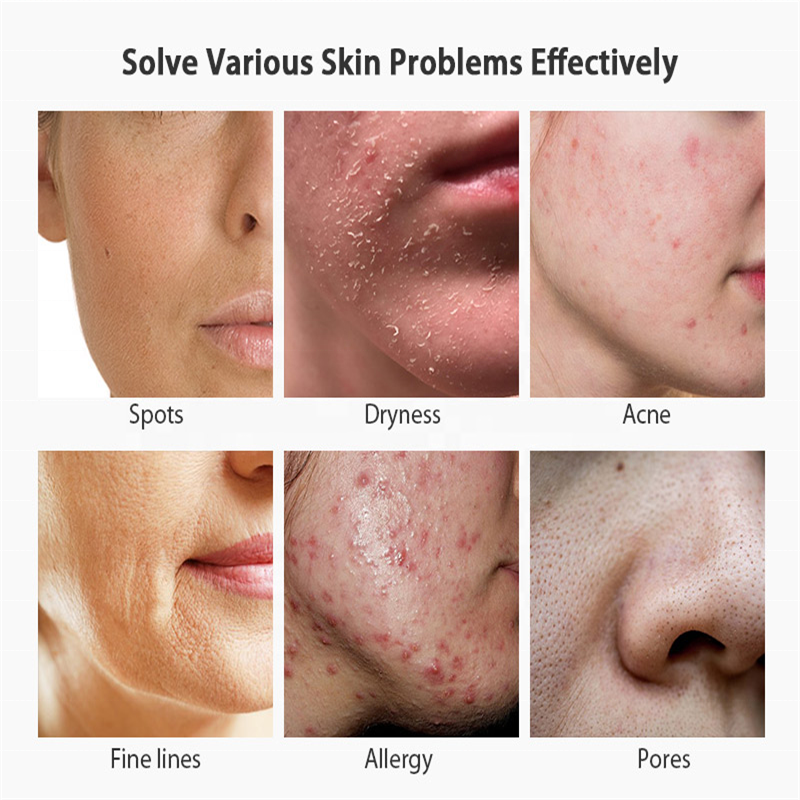 Manuka Honey Clay Mask Manufacturer - OEM Natural Hydrating Oil-Control with Aloe Vera Algae