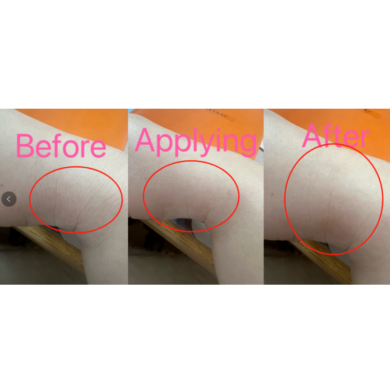 Anti Aging Serum Manufacturer - OEM Stock Wholesaler 1 Week Wrinkle Removal Fast Lines