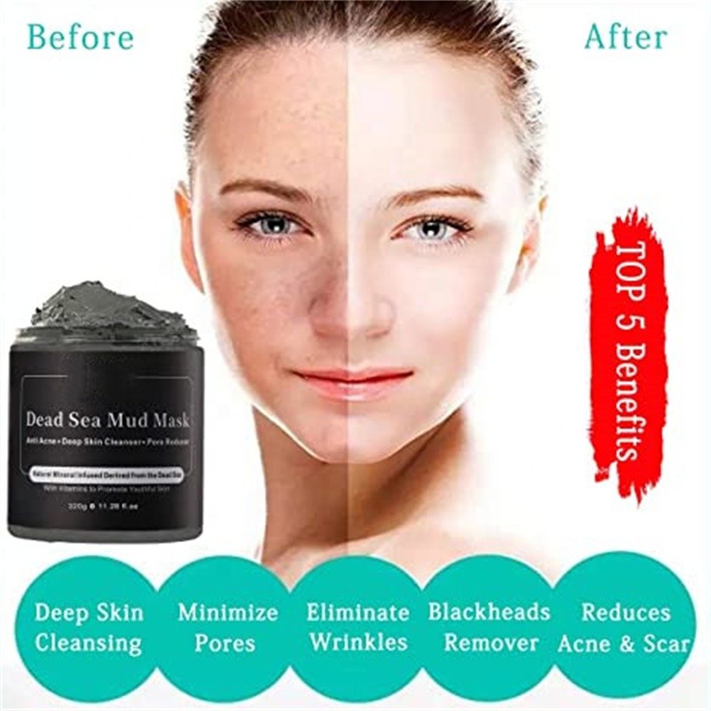 Dead Sea Mud Mask Manufacturer - OEM for Face Body Oil Control Blackhead Removal Pores