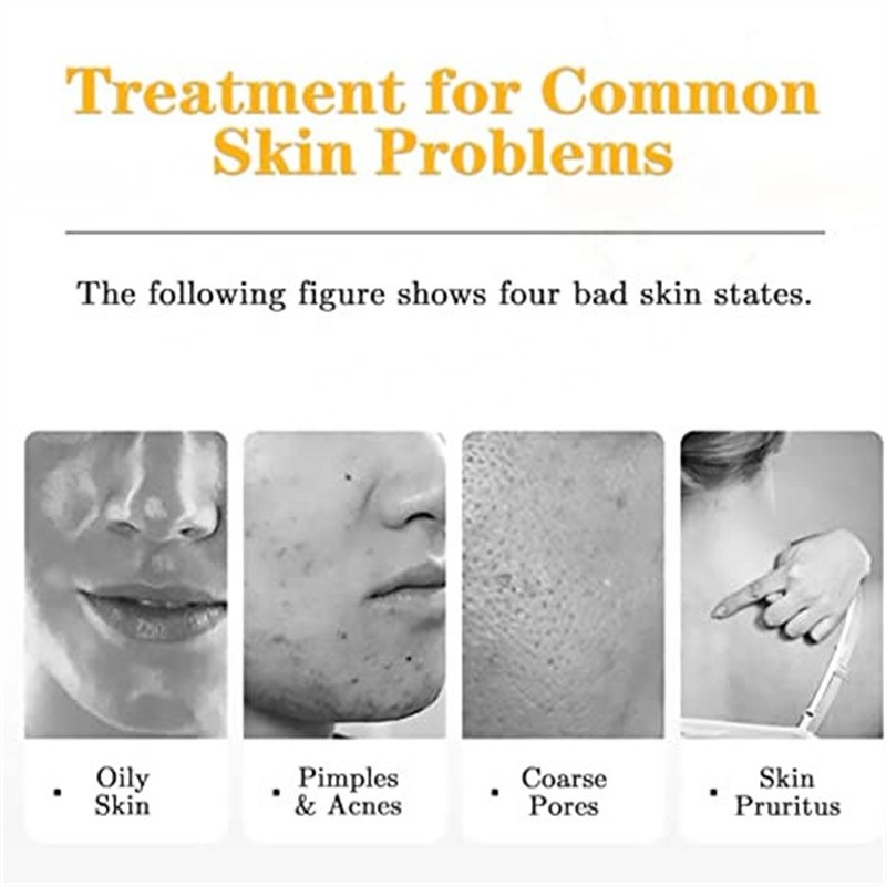 Salicylic Acid Cleanser Manufacturer - OEM TOP Oil Free Pink Grapefruit Anti Acne Shrink Pores