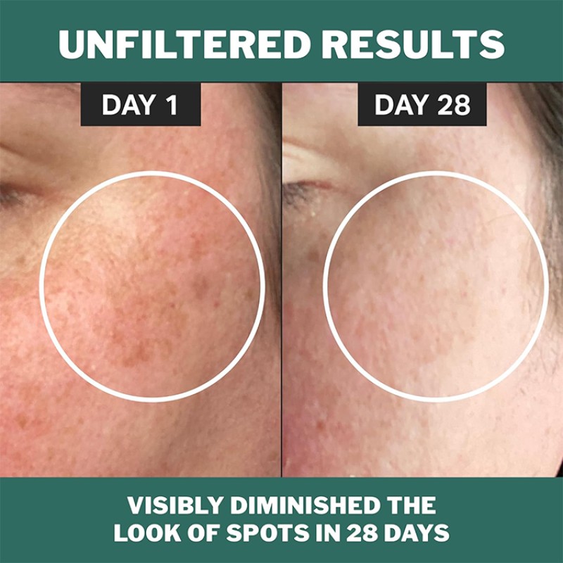 Niacinamide Serum Manufacturer - OEM Customized Private Label Organic Spot Fading 1 Fl oz