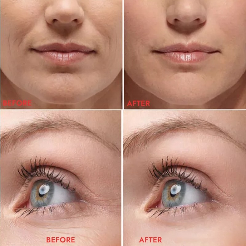 Hyaluronic Acid Serum Manufacturer - OEM Skin Care Vegan Moisturizing Anti-Wrinkle Brightening