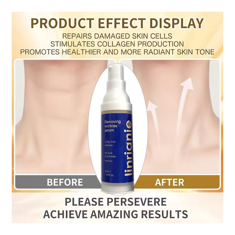 Anti Aging Serum Manufacturer - OEM Fast Wrinkle Removal for Face Neck Old Age Lines