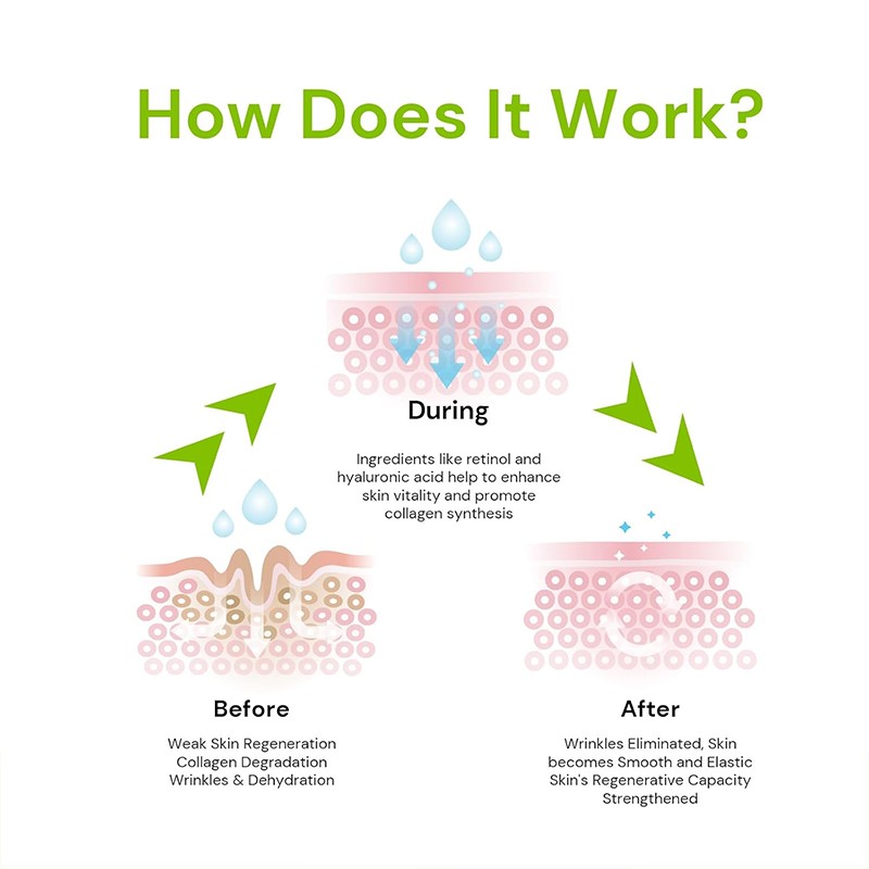 Anti Aging Serum Manufacturer - OEM Fast Wrinkle Removal for Face Neck Old Age Lines