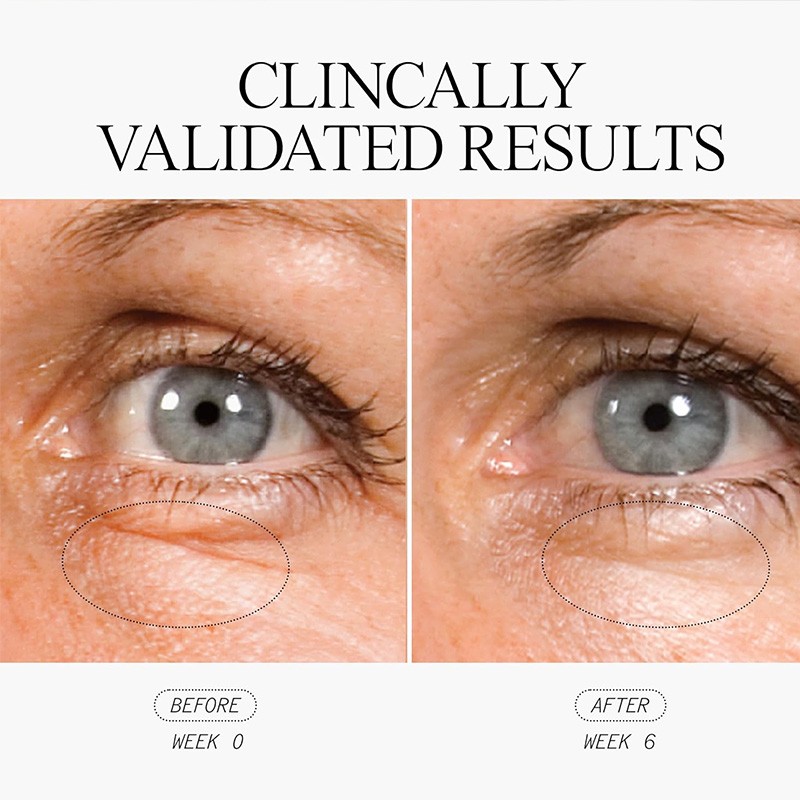 Eye Gel Manufacturer - OEM Private Label Aqua Bomb Cooling with Caffeine Hyaluronic Acid