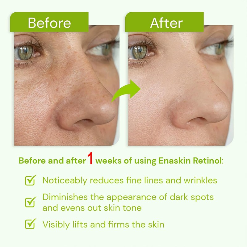 Wrinkle Removal Serum Manufacturer - OEM Advanced Technology Super Fast 1 Week Anti Aging