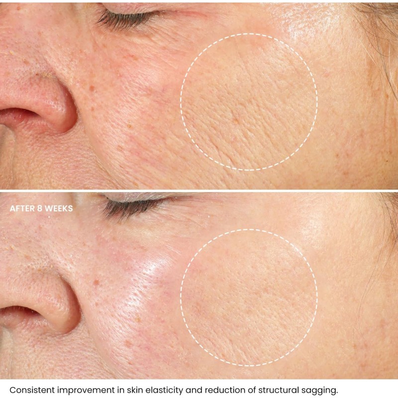 Apple Stem Cell Serum Manufacturer - OEM Hot-selling 30ml Brightening Skin Tone Liquid