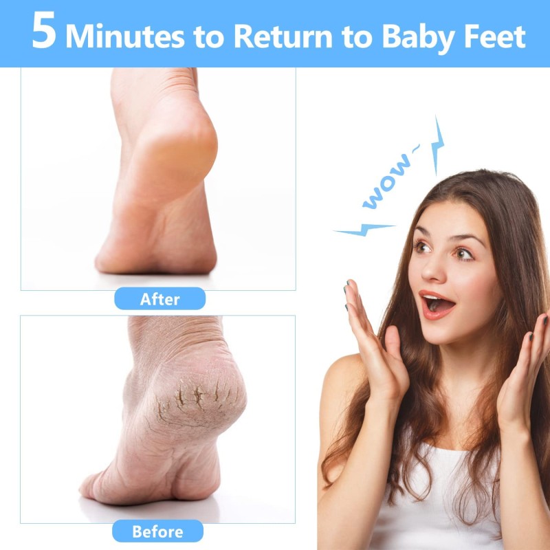 Foot Scraper Manufacturer - Professional Large Stainless Steel Callus Remover Pedicure