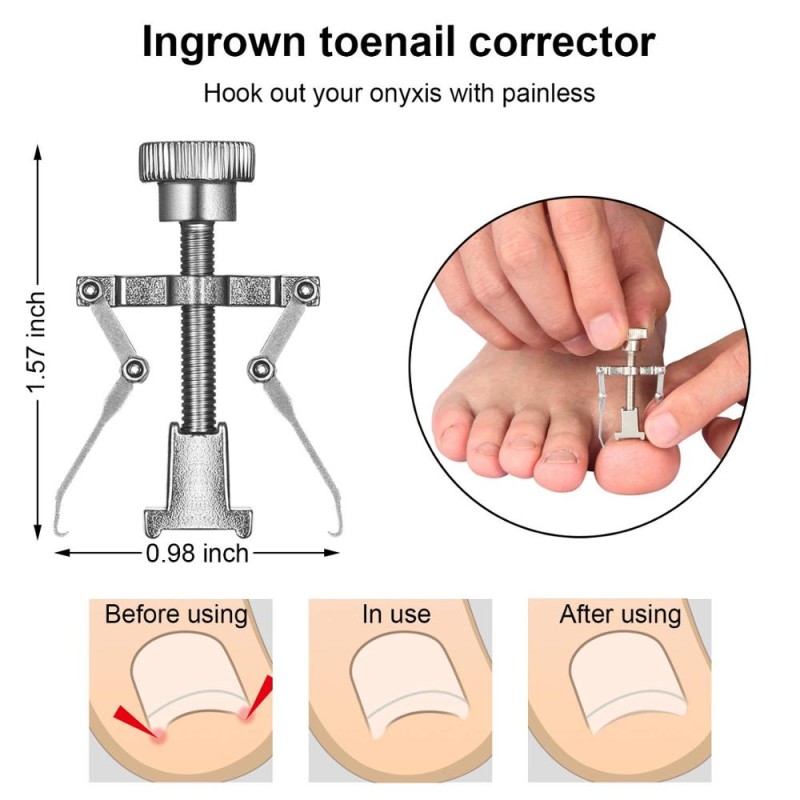 Ingrown Toenail Kit Manufacturer - 7 Pcs Stainless Steel Pedicure Correction Remover Tools