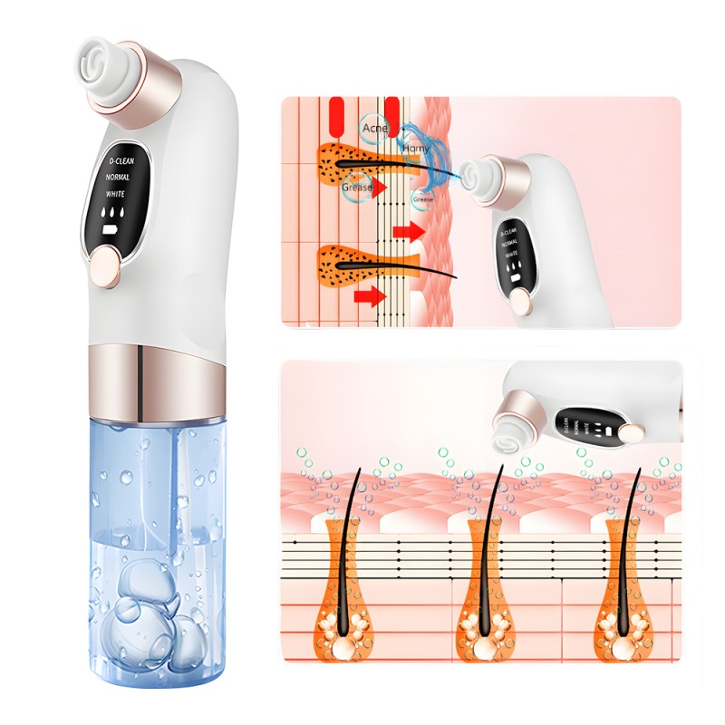 Electric Blackhead Remover - Vacuum Acne Treatment Supplier