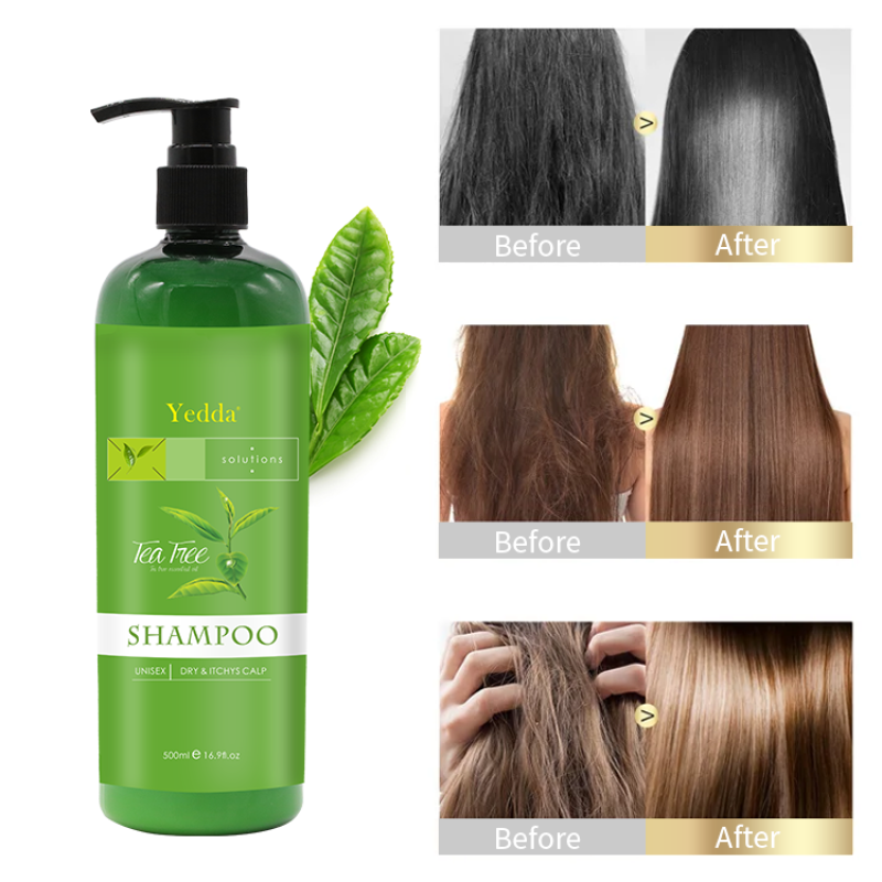 Anti Dandruff Set - Herbal Shampoo Conditioner