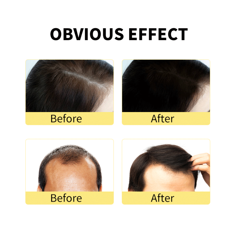 Ginger Shampoo Set - 500ml Hotel Use OEM