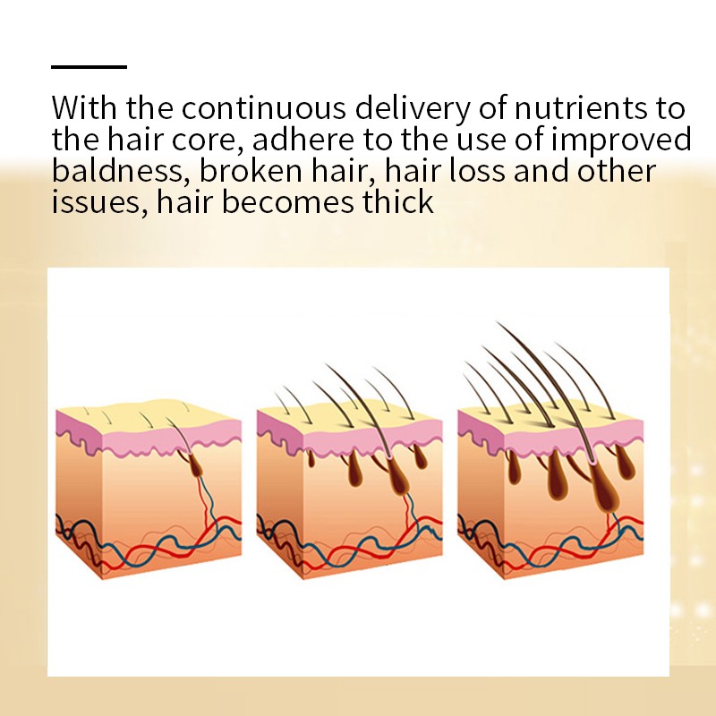 Hair Growth Shampoo - 200ml Herbal Formula