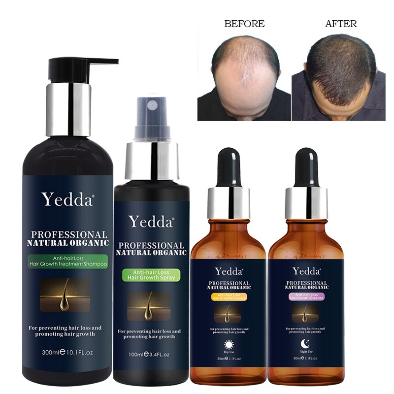 Hair Growth Shampoo - Fast Regrowth Private