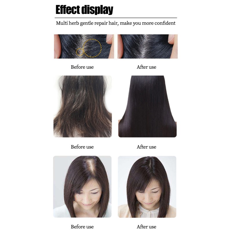 Anti Dandruff Shampoo - Plant Extract Custom