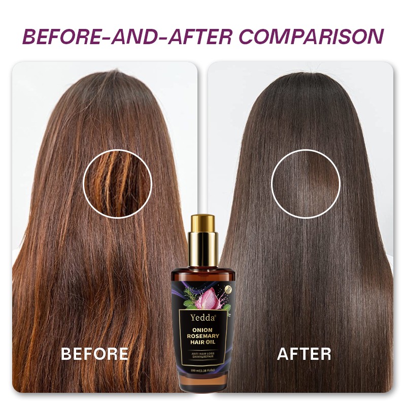 Onion Hair Care Set - Biotin Repair Formula