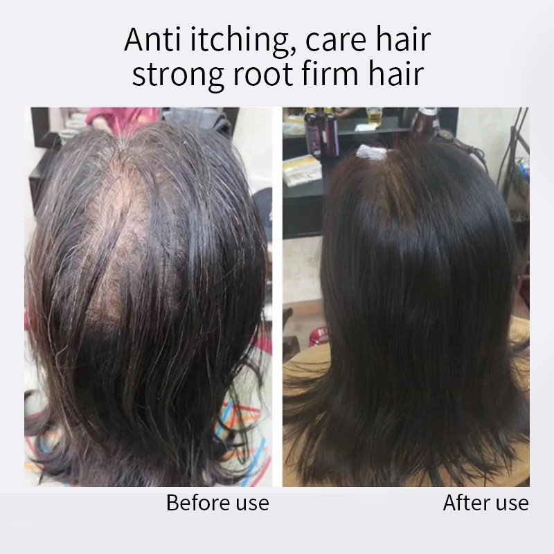 Hair Growth Shampoo - 200ml Herbal Formula