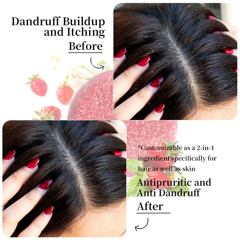 Anti Dandruff Shampoo - Organic Refreshing OEM