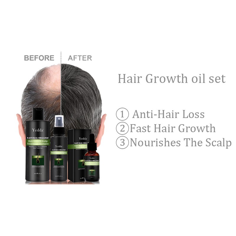 Professional Hair Oil - 30ml Organic Growth