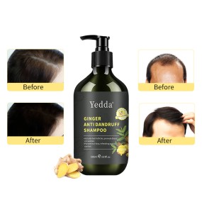 Ginger Shampoo Set - Anti Hair Loss OEM