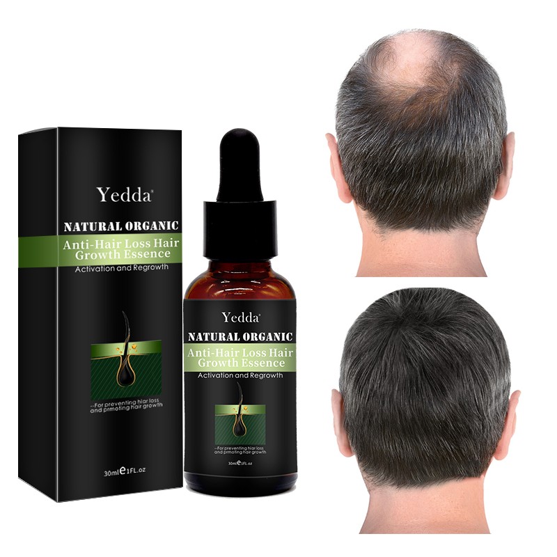 Hair Growth Oil - Custom Herbal 30ml OEM