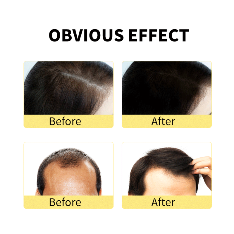 Ginger Hair Conditioner - Herbal Deep Conditioning