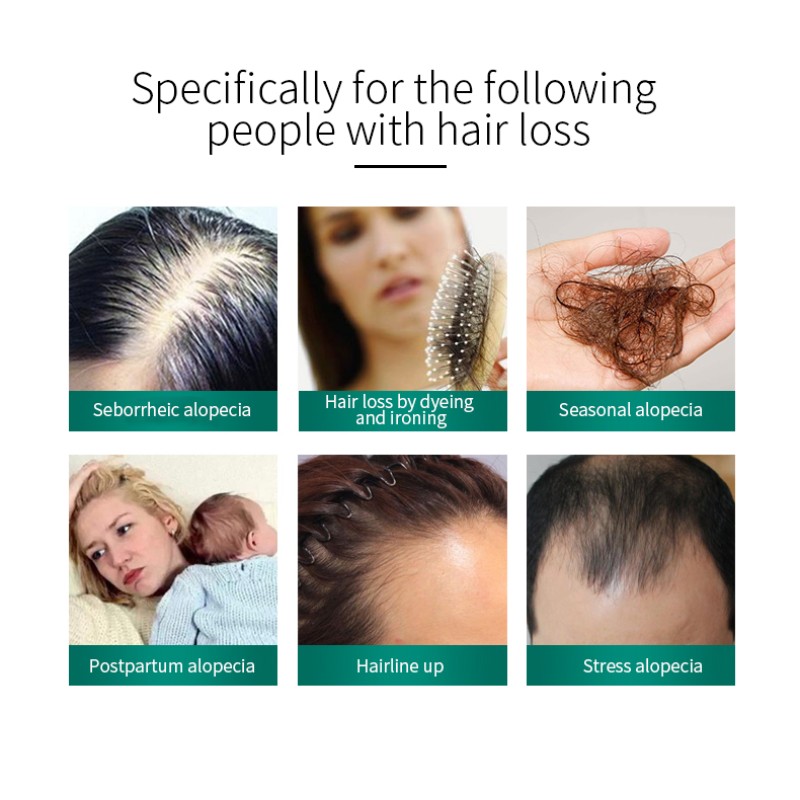 Anti Hair Loss Shampoo - 2-in-1 Sulfate Free