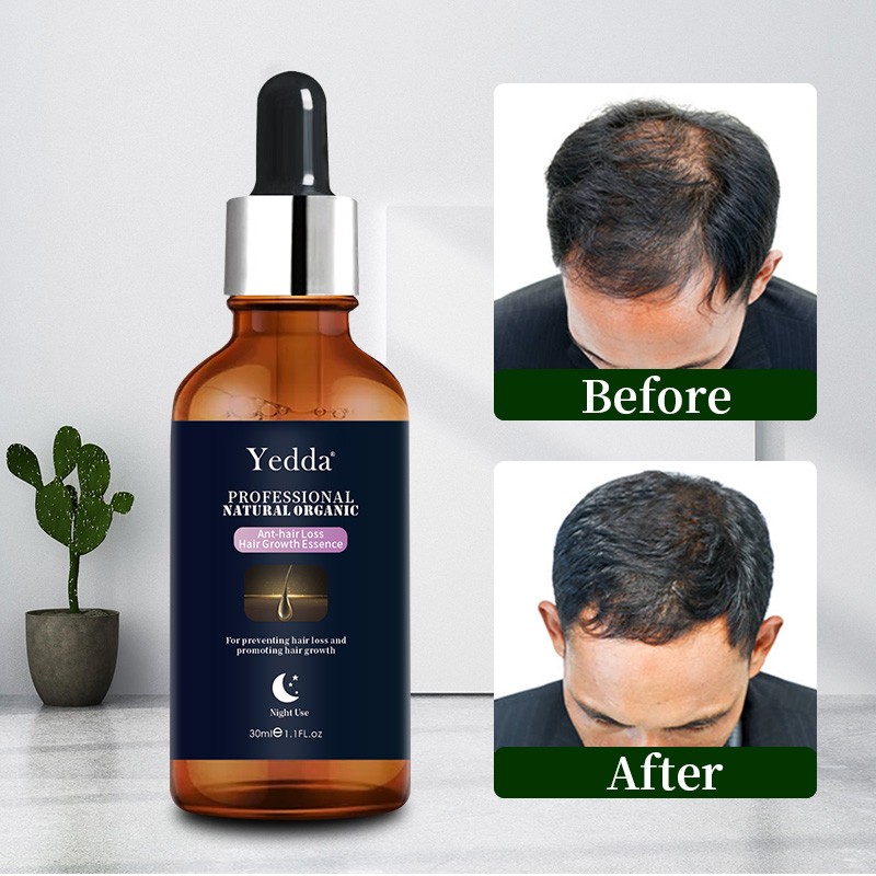 Ginseng Shampoo - 2-in-1 Dandruff Control