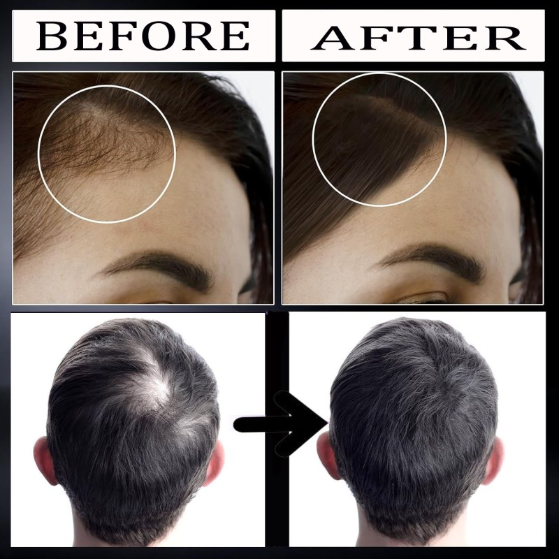 Children's Shampoo Gel - 2-in-1 Refreshing