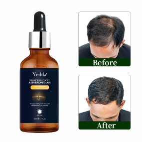 Hair Growth Oil - Organic for Curly Hair