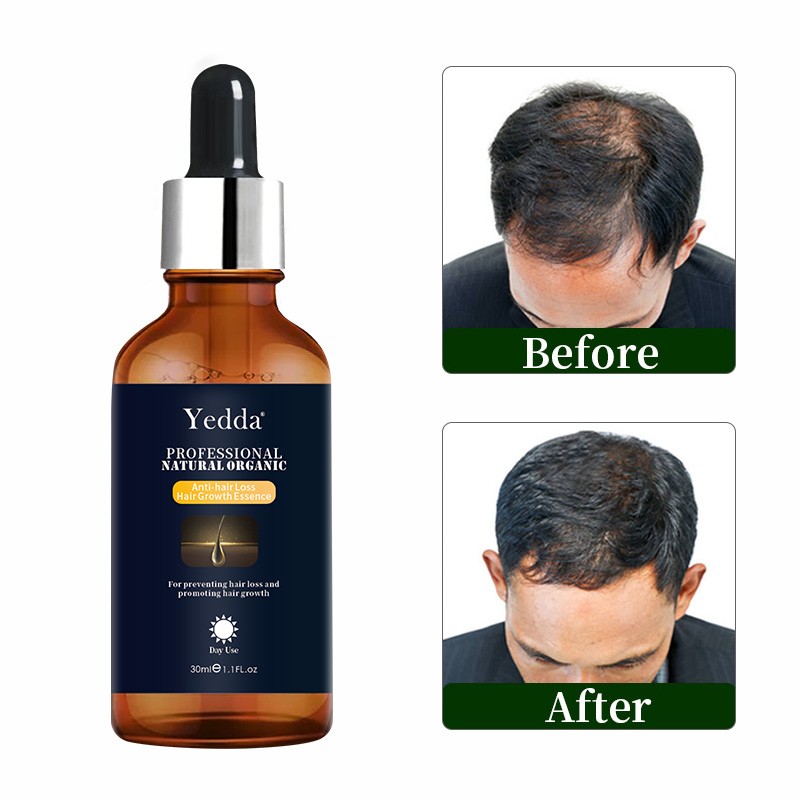 Hair Growth Oil - Organic for Curly Hair