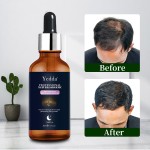 Anti-Loss & Regrowth Series