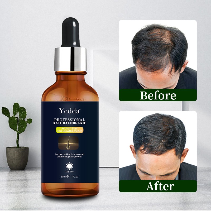 Ginseng Shampoo - 2-in-1 Dandruff Control