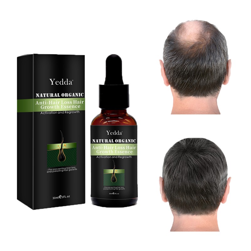 Men's Hair Oil - 30ml Growth Treatment