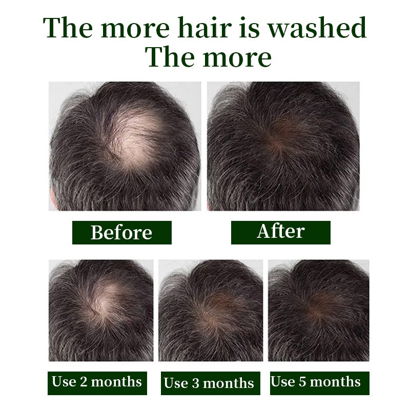 Hair Growth Spray - Natural Organic Private