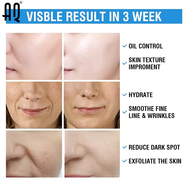 Exfoliating Pads Manufacturer - Customized Gentle Cleansing Peeling Vitamin Salycilic Glycolic Serum Acne