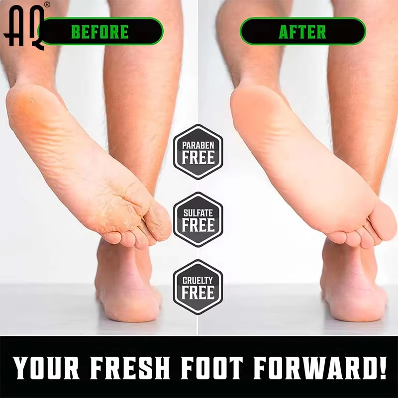 Foot Cream Manufacturer - AIQI Customized Urea Cracked Heels Exfoliating Anti Crack Dead Skin Removal