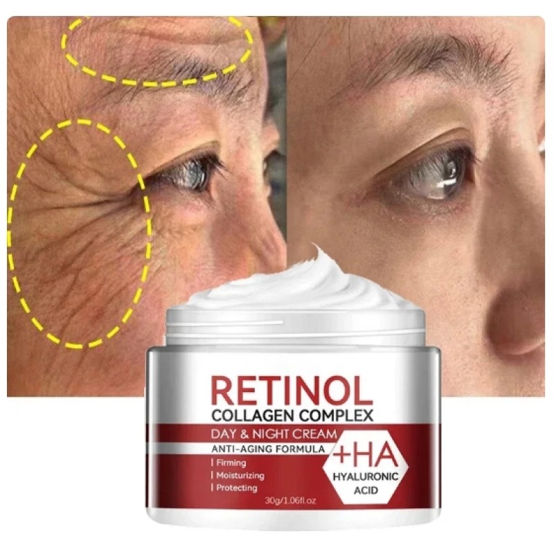 Anti Aging Moisturizing Cream Retinol Removing Wrinkle Fade Fine Line Firming Lifting Hydratation Brightening Skin Care Cosmetic