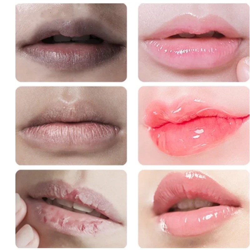 Korean Beauty Health Lip Balm Travel Lightening Dilute Melanin Gloss Oil Exfoliating Clean Deep Moisturizing Cream for Face