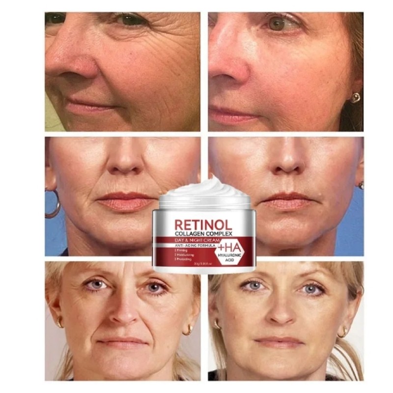 Anti Aging Moisturizing Cream Retinol Removing Wrinkle Fade Fine Line Firming Lifting Hydratation Brightening Skin Care Cosmetic