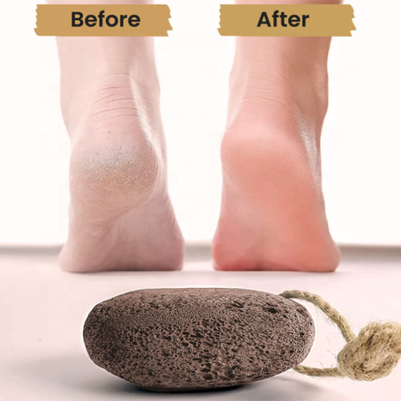 Volcanic Stone - Natural Pumice Callus